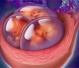 关于试管婴儿的你是否也有以下这些疑惑